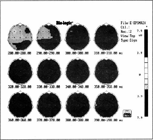 Figure 2c.