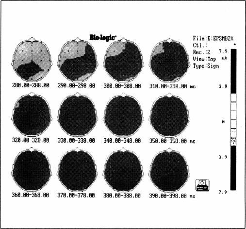 Figure 2b.