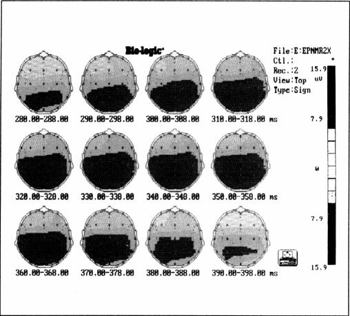 Figure 1c.