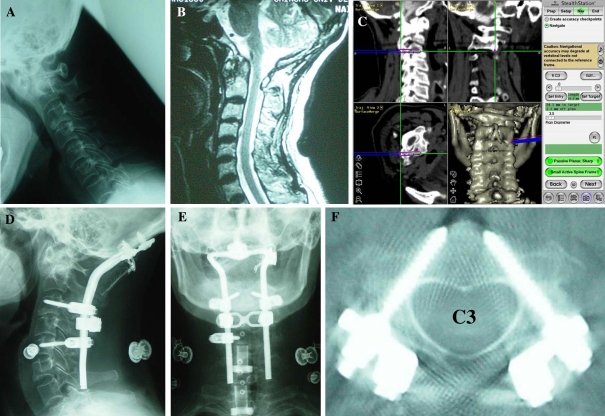 Fig. 6