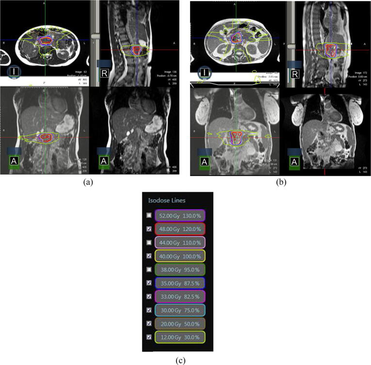 Fig. 4