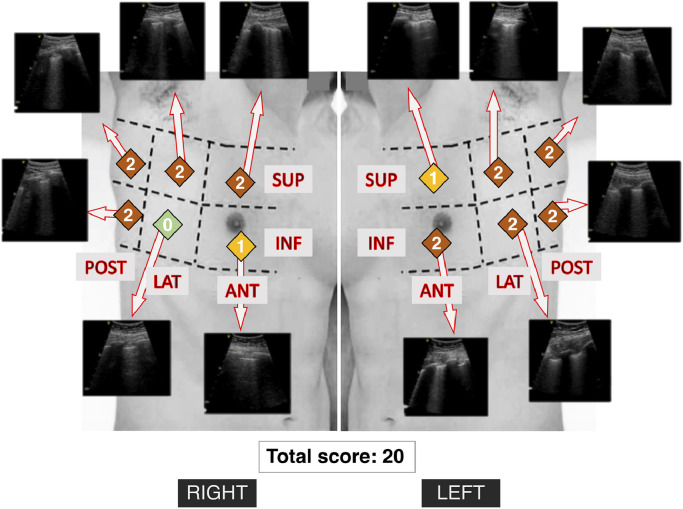 Fig 1