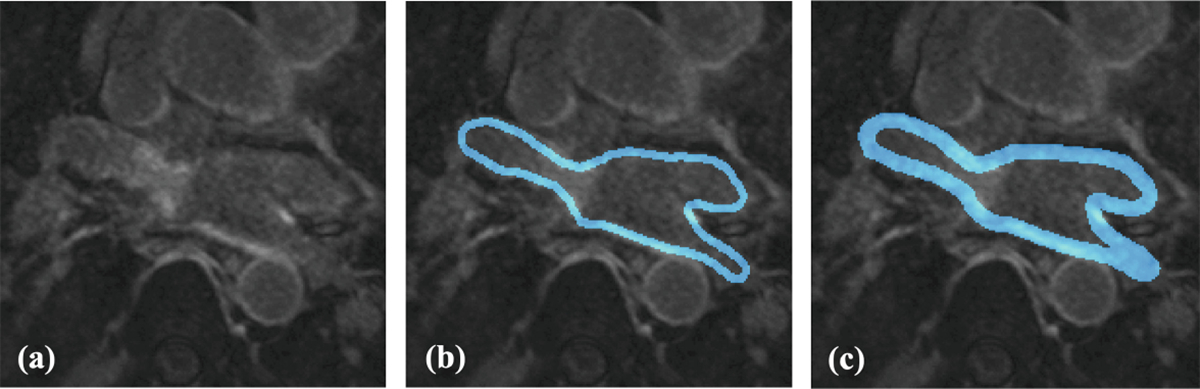 Fig. 6.