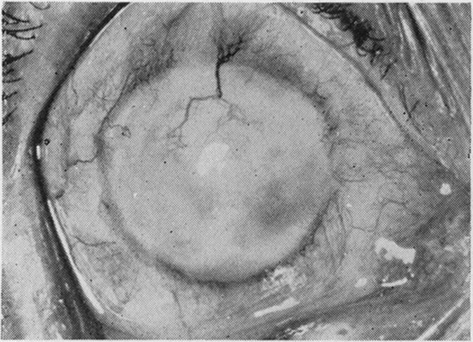 Fig. 12