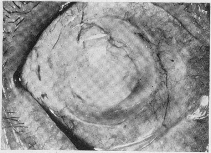 Fig. 13