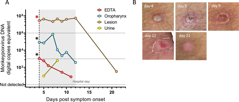 Fig 2: