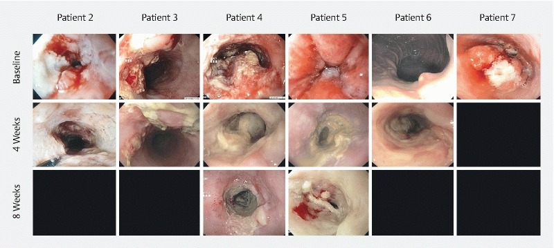 Fig. 2