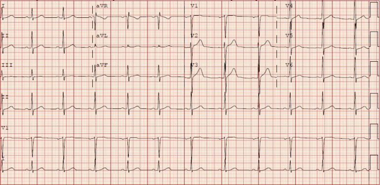 Fig. 1