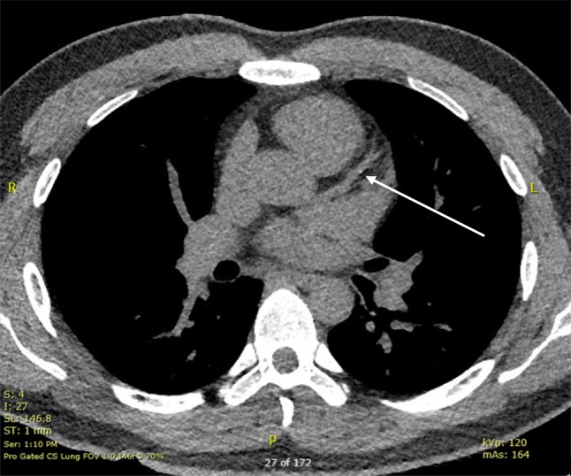 Fig. 2