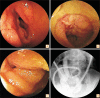 Fig. 1