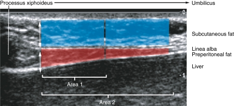 Fig. 1