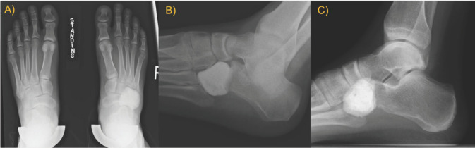 Figure 4A to 4C.