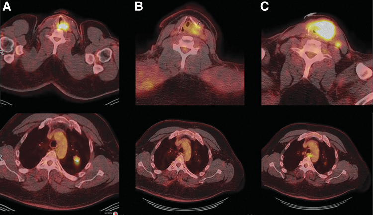 FIG. 2.