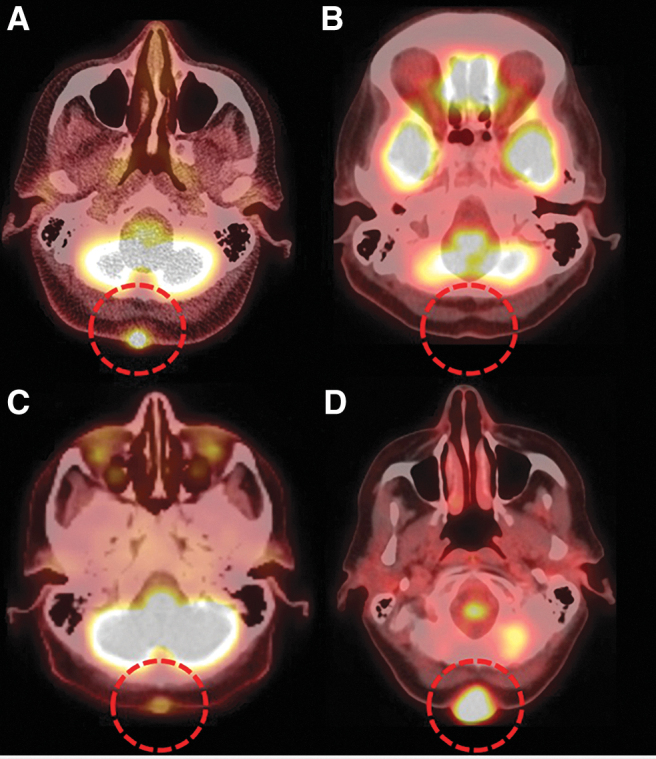 FIG. 1.