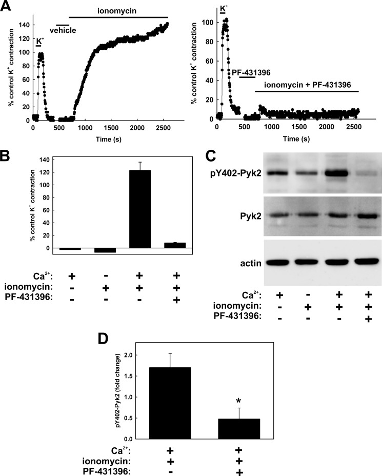 FIGURE 11.