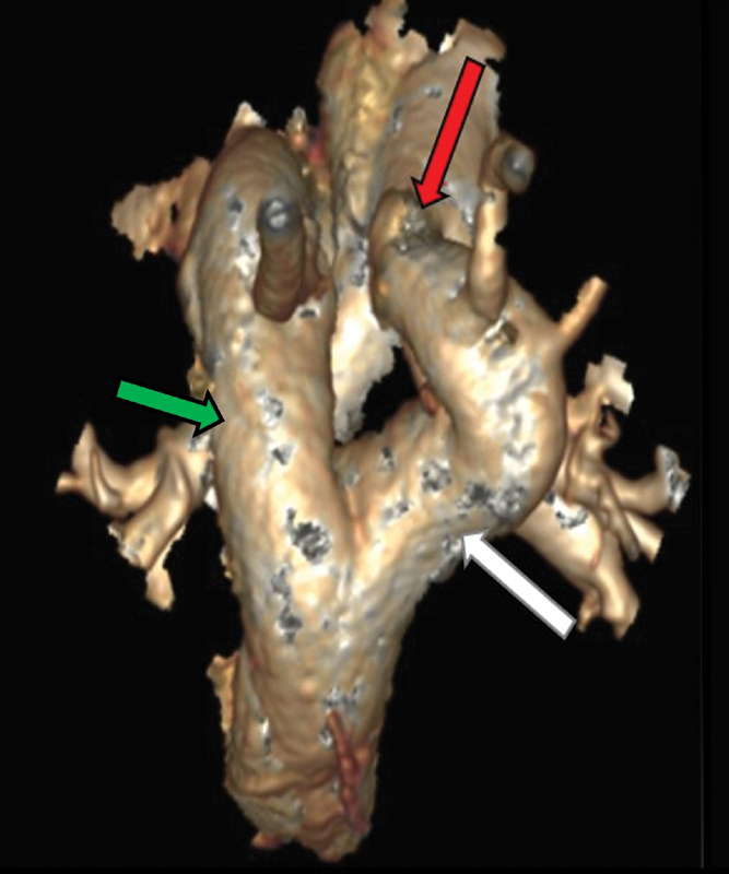 Fig. 13