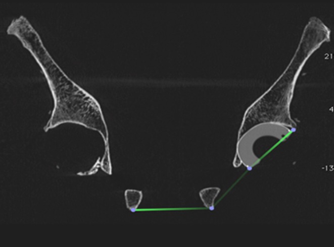 Fig. 3