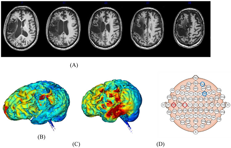 Figure 1: