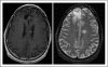 Fig 1.
