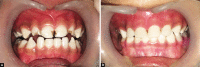 Figs 1A and B