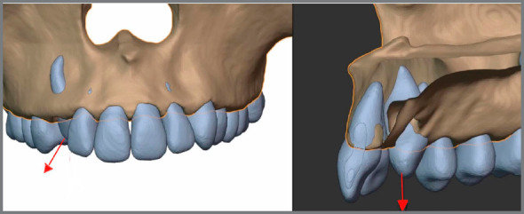 Figure 11: