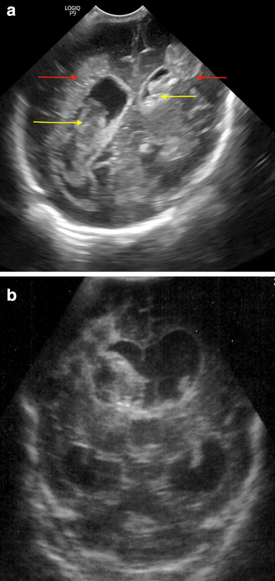 Fig. 5