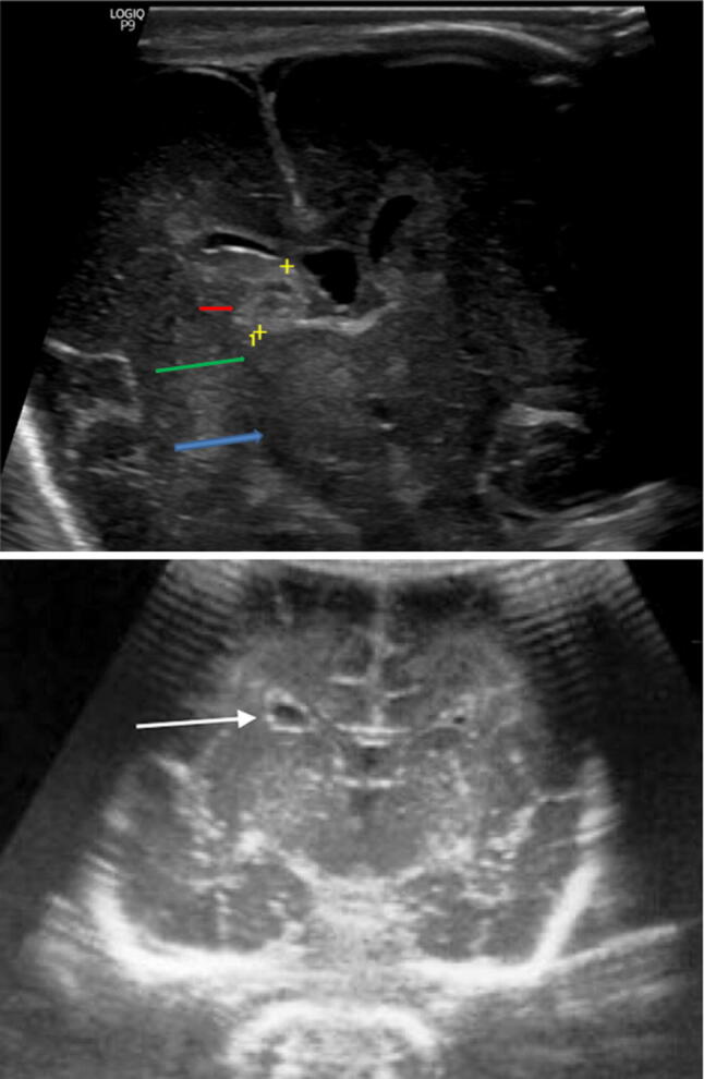 Fig. 2