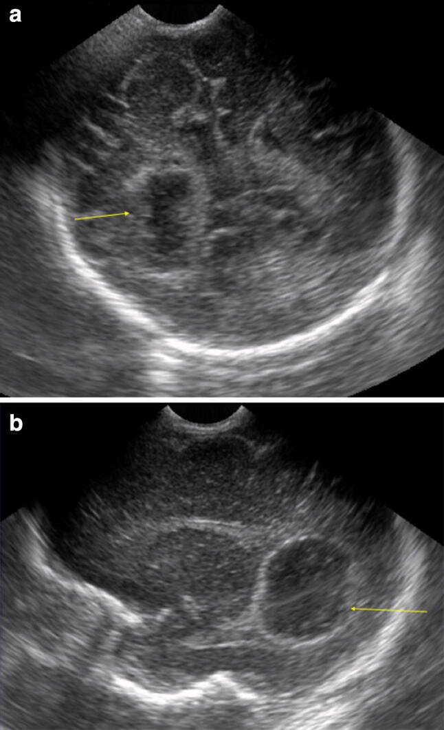 Fig. 10