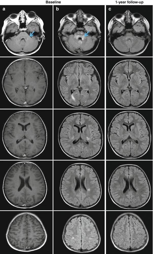 Fig. 5.2