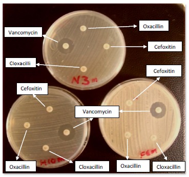 Fig. (1)