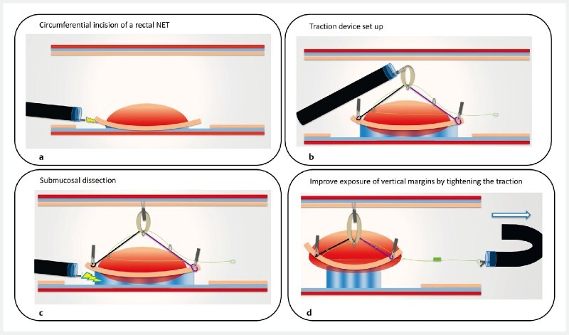 Fig. 1