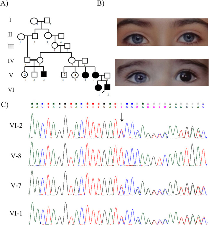 Fig. 1