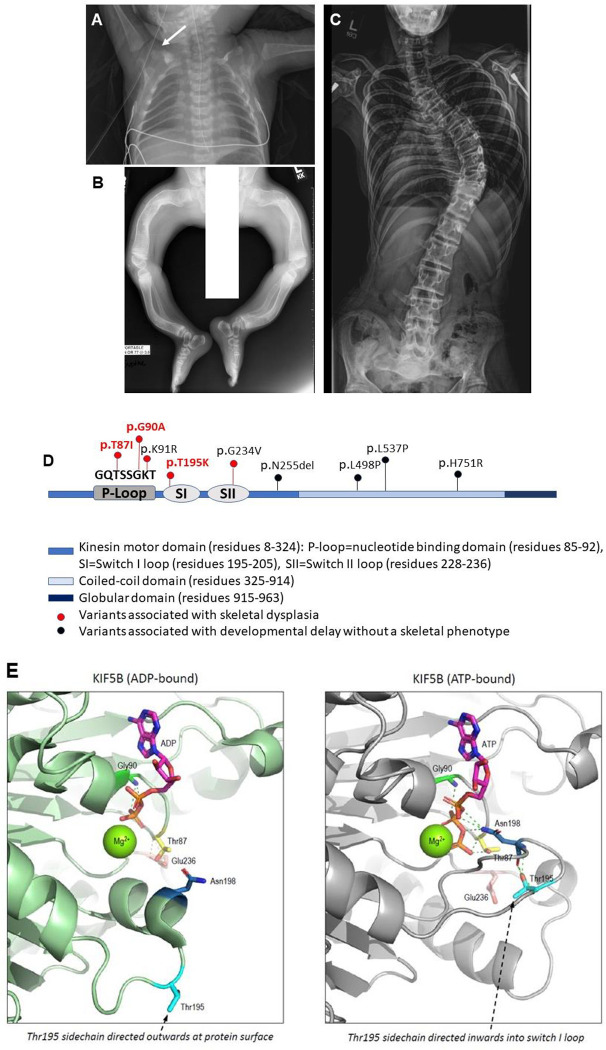 Fig 1