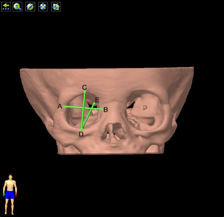 Fig 2