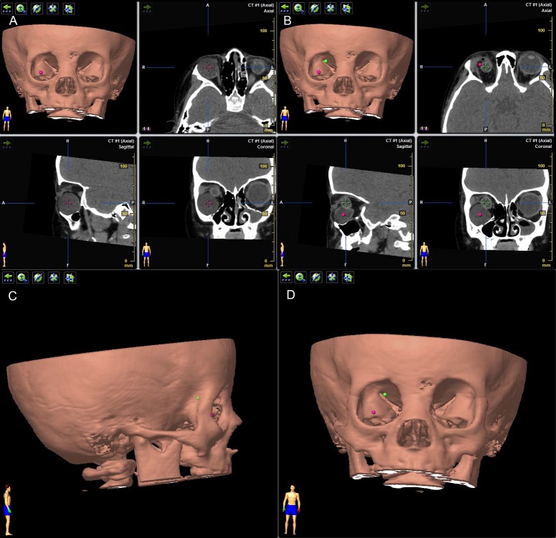 Fig 5