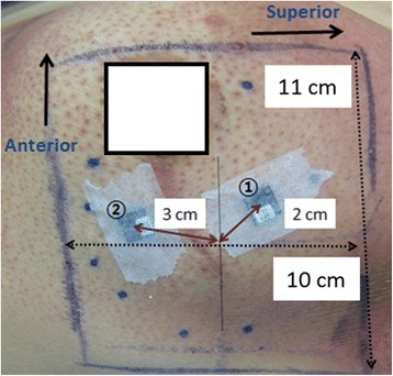 Fig. 2