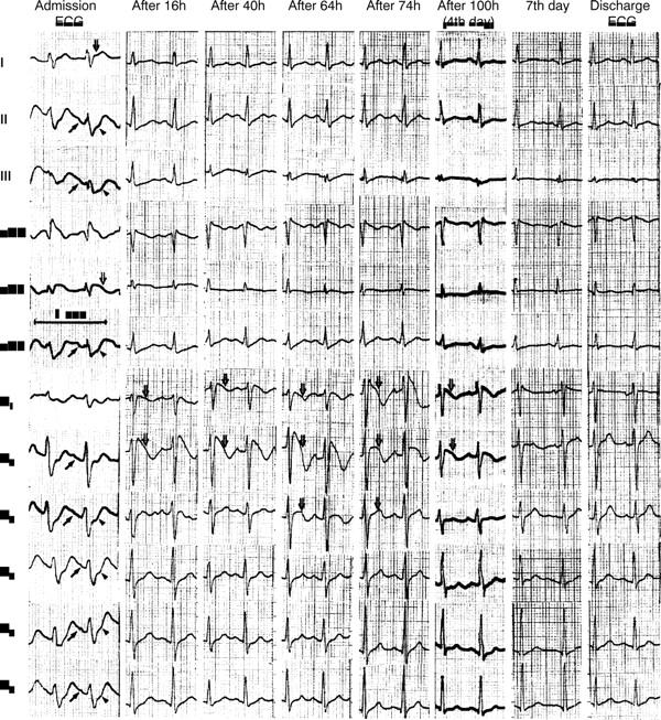 Figure 1  