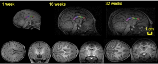 Fig. (2)