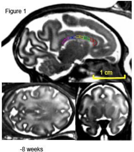 Fig. (1)