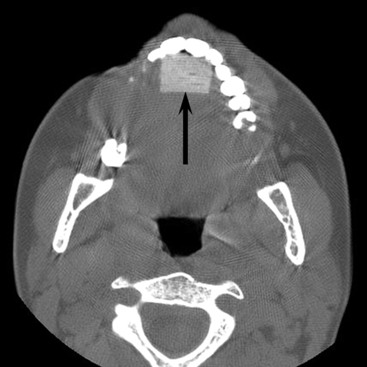 Fig 6.