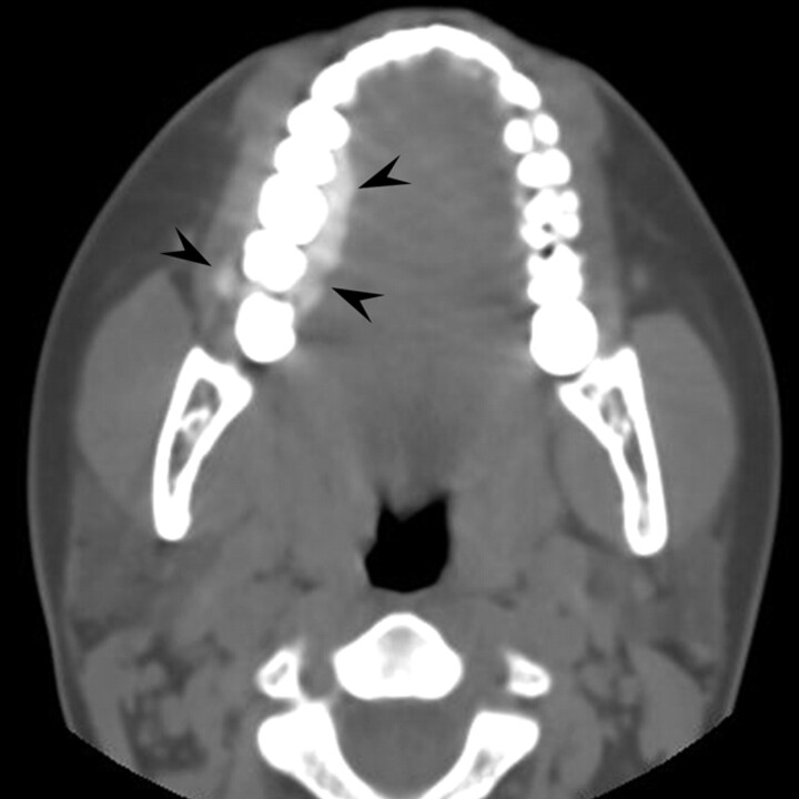 Fig 3.