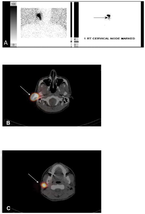 FIG. 1