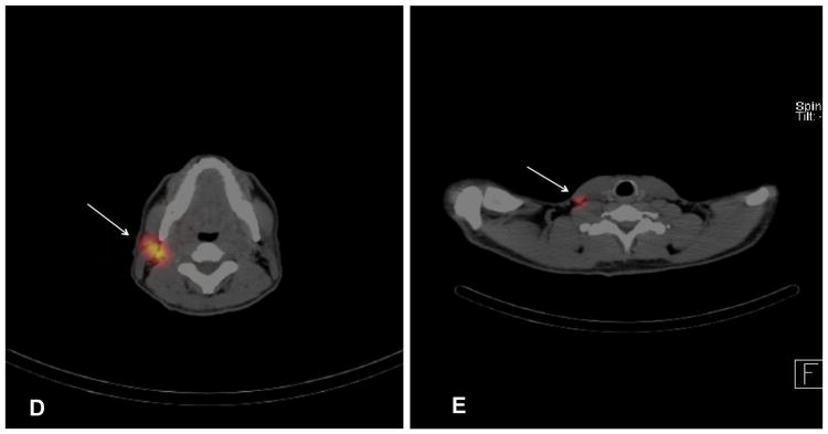 FIG. 1