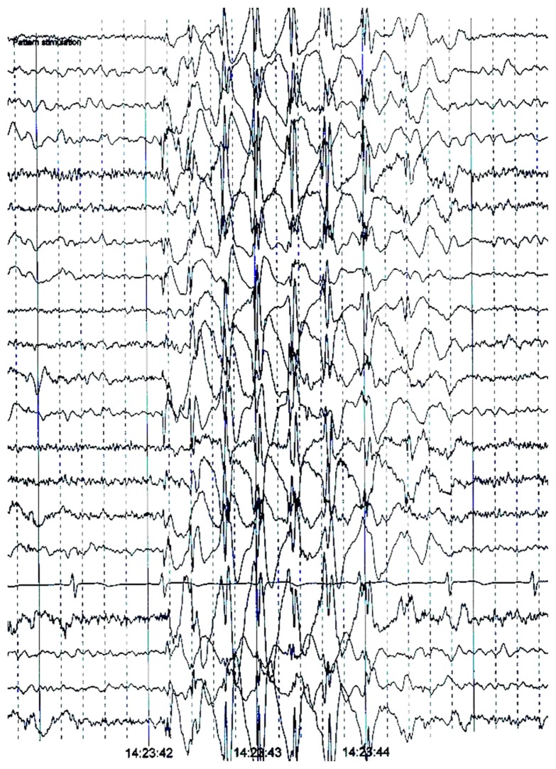 Figure 5