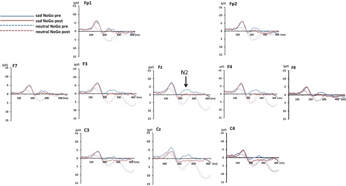 Fig. 1