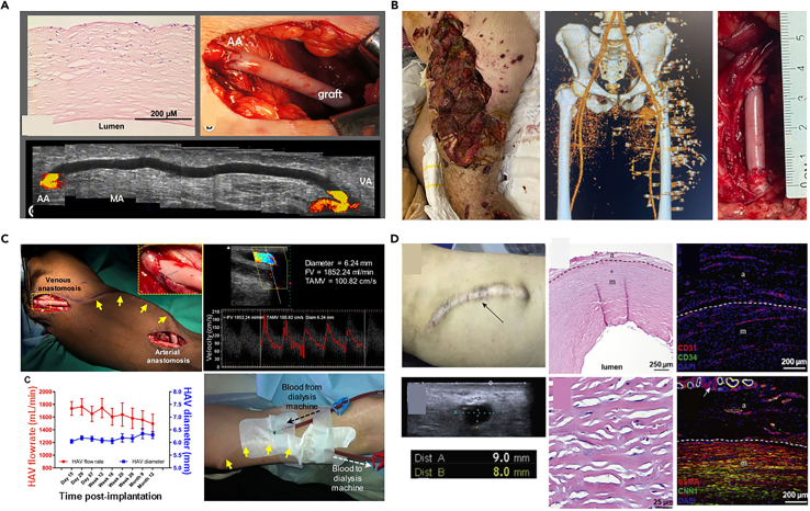 Figure 12