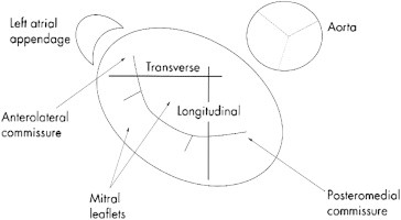 Fig. 1