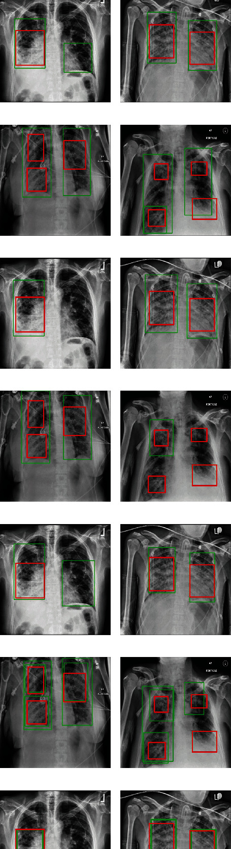 Figure 11