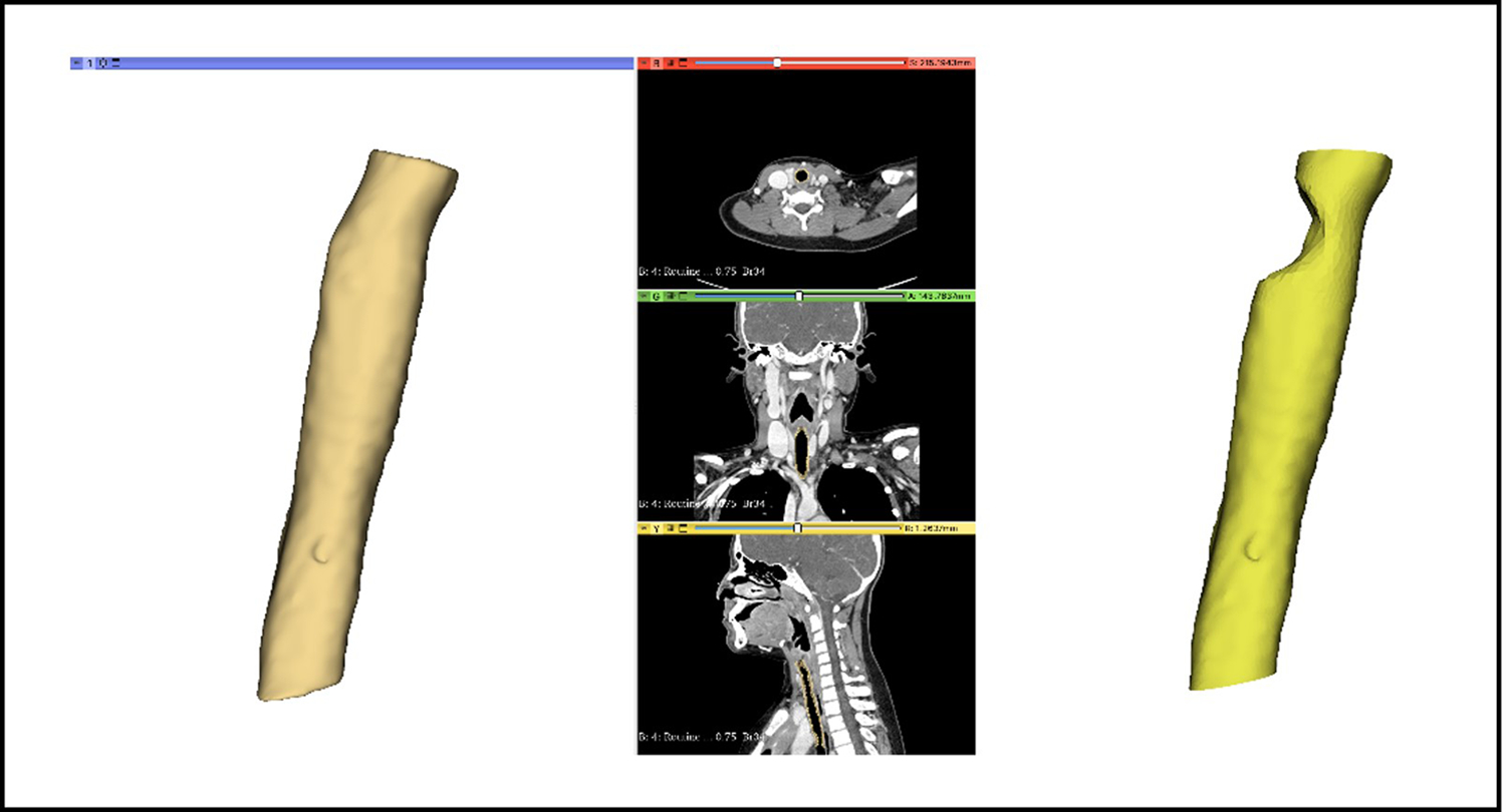 Figure 2.