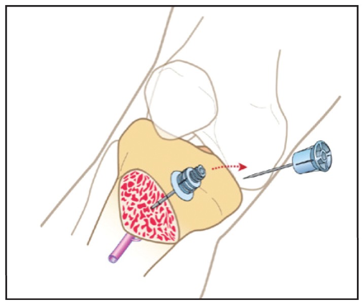 Figure 1: